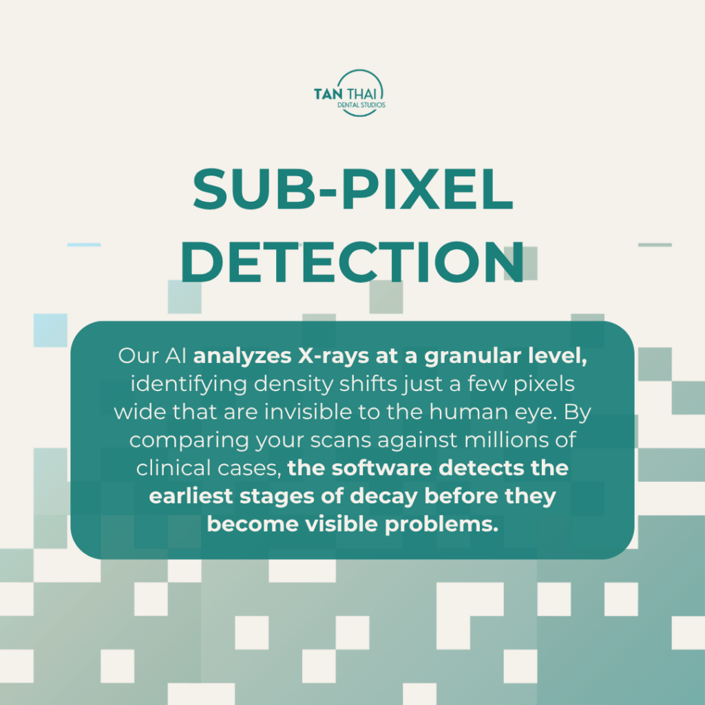 Close-up of a high-resolution digital dental X-ray using AI sub-pixel detection to identify microscopic enamel demineralization that is invisible to the naked eye.
