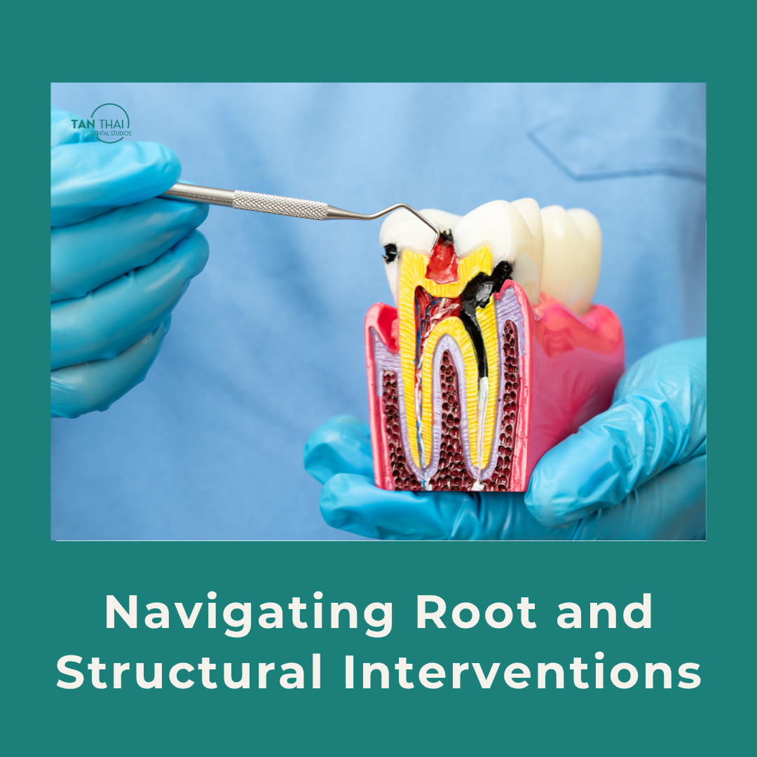 A close-up view of modern endodontic diagnostic equipment and a dental tooth restoration model at Tan Thai Dental Studios in Vallejo, CA.