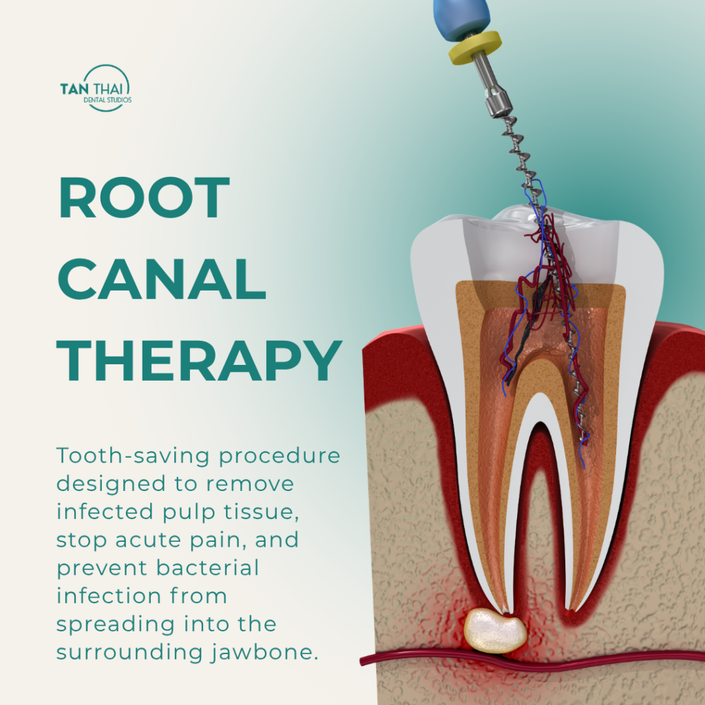 root